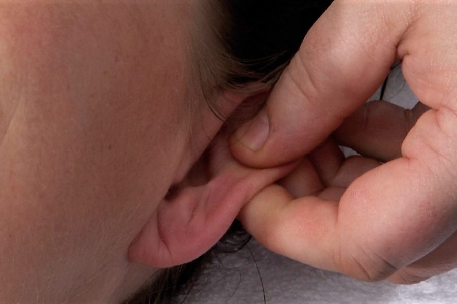 auricular